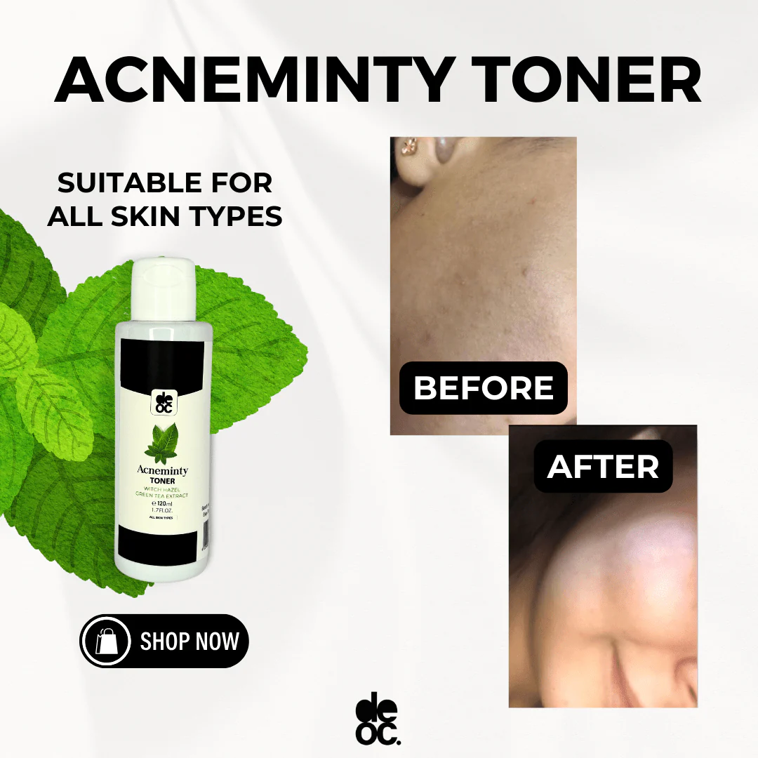 NO-ACNE PACK - Image 9