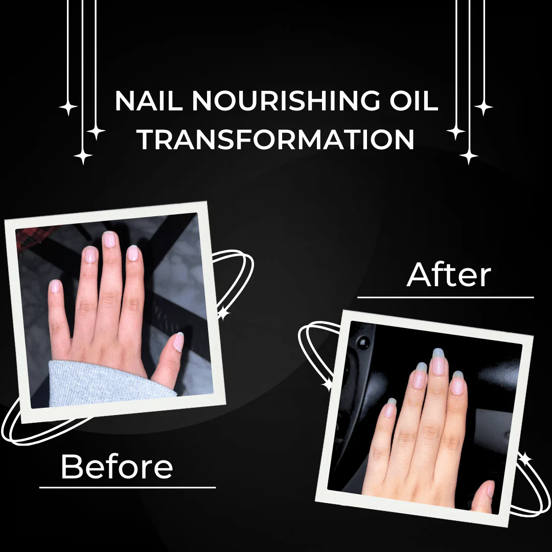 Nail Magic Nourishing oil - Image 3